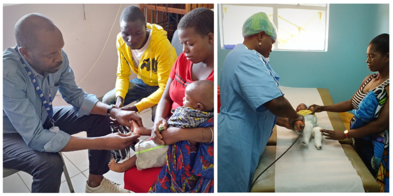 Families attend Hope Walks' clubfoot clinic in Lusaka, Zambia for treatment